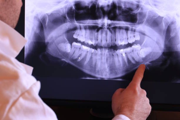 Best Pediatric Emergency Dentist in Rochelle, IL