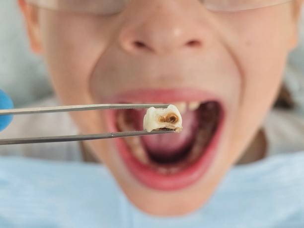 Best Emergency Dental Care for Trauma or Injury in Rochelle, IL
